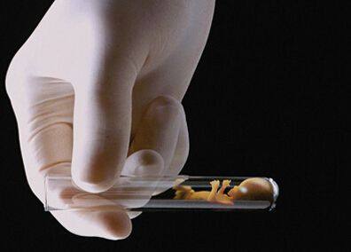 专业拉拉代怀助孕费用多少